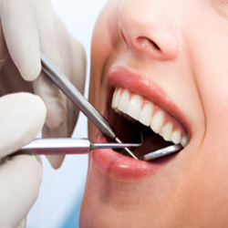 Dental Cleanings and Preventions