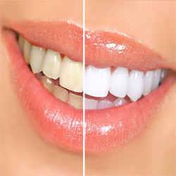 Cosmetic Dentistry