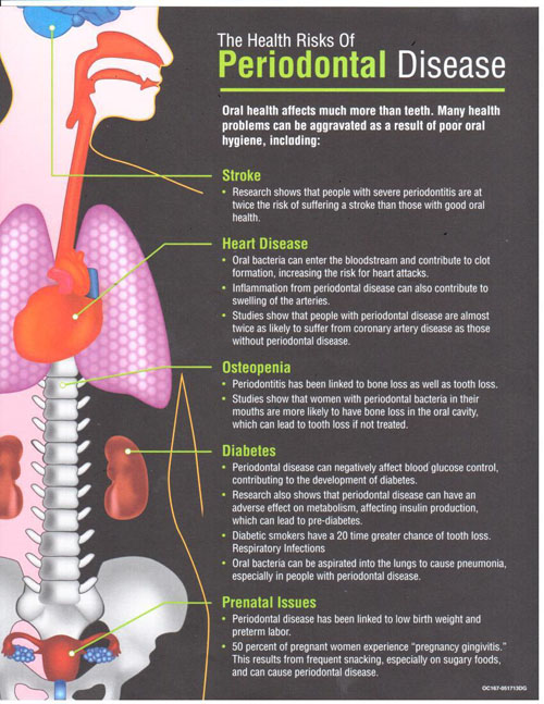 Periodontal Disease