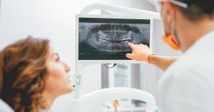 dental x rays